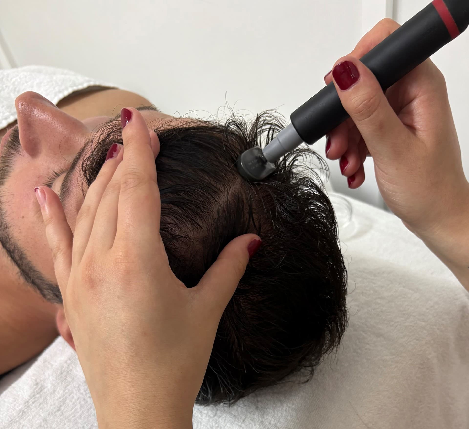 Indiba capilar en O Porriño