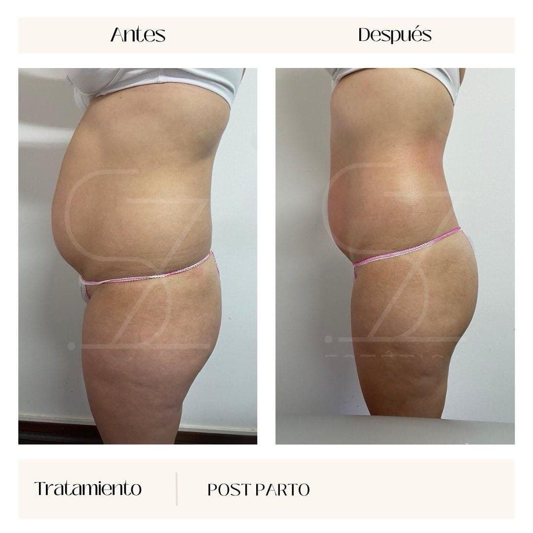 Tratamientos corporales en O Porriño