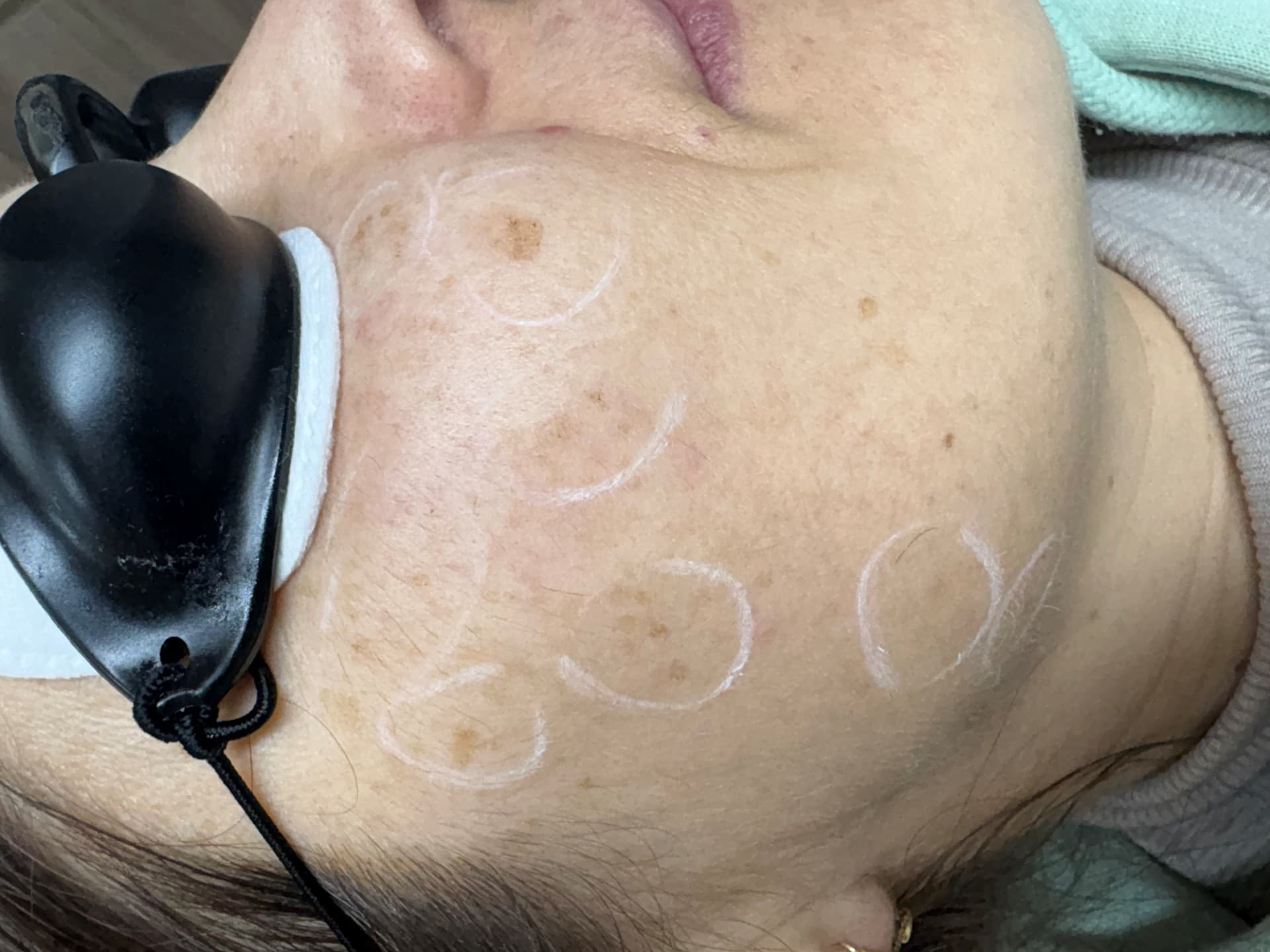 Fhos intensive en Porriño