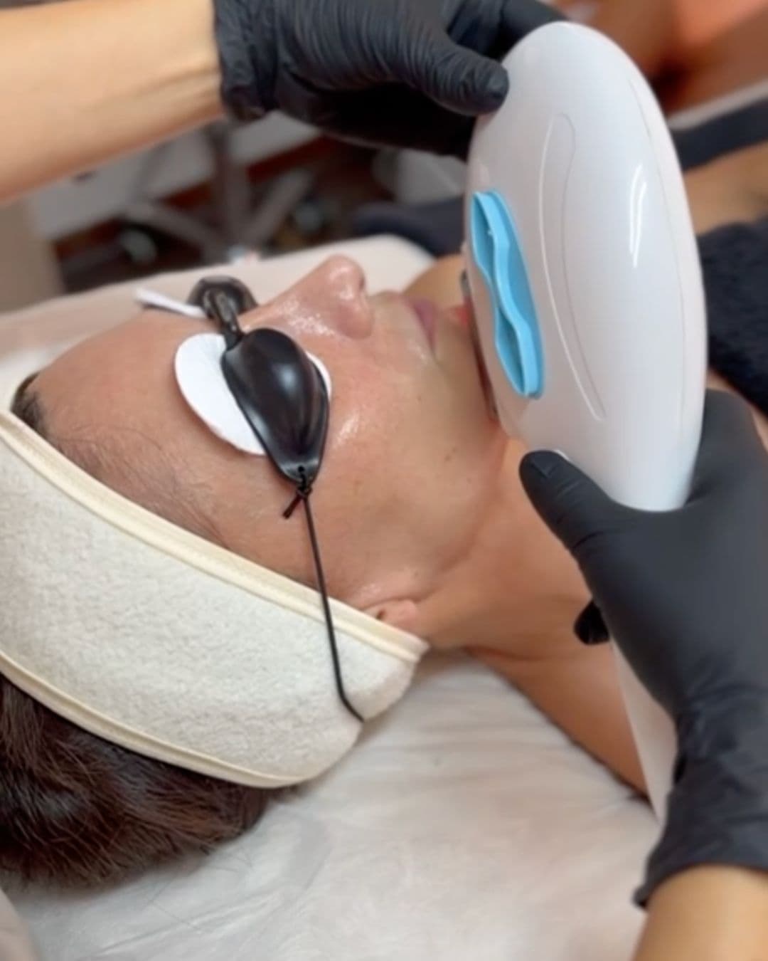 Fhos repair en Porriño