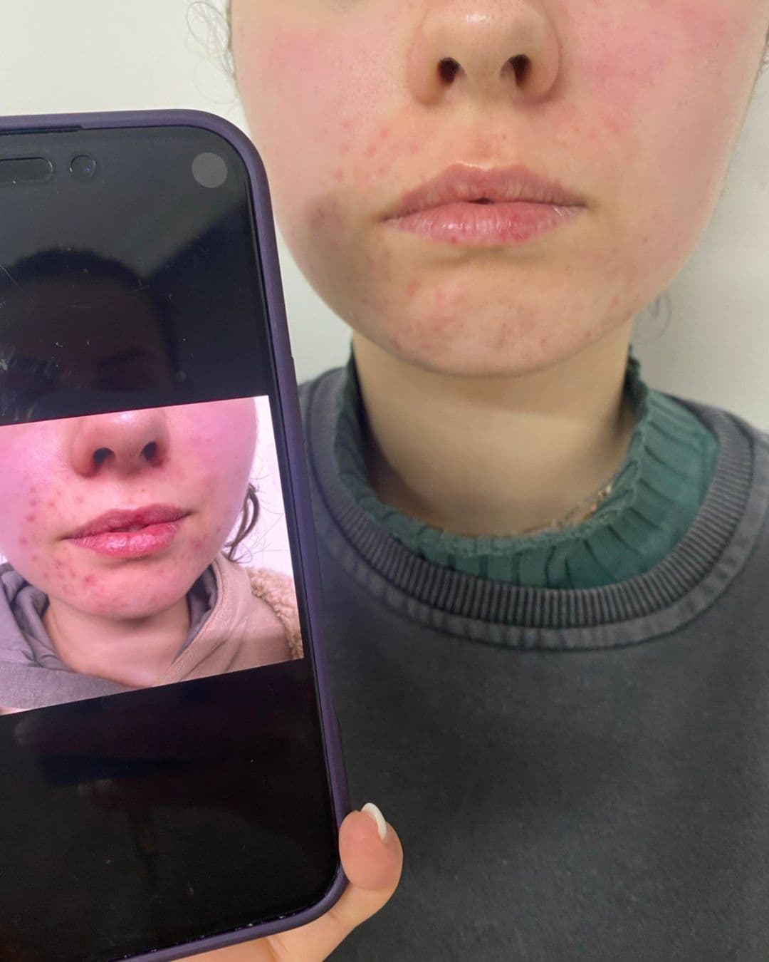 Higiene junior en Porriño