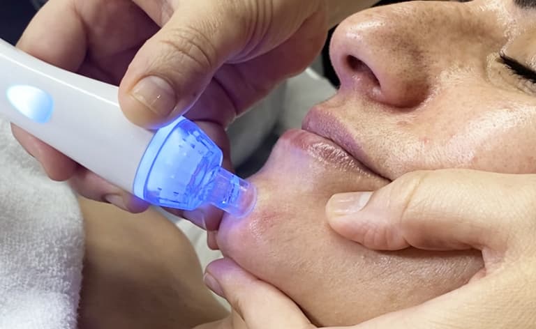 Hydra - Pure en Porriño