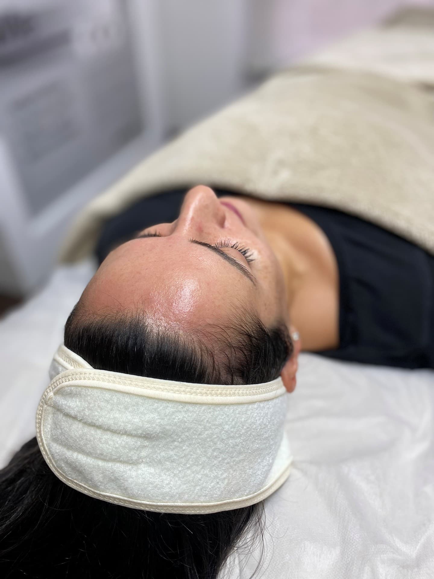 Peeling Premium en Porriño