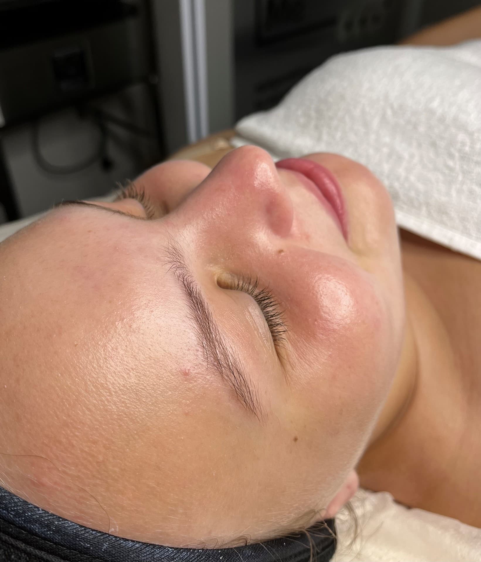 Peeling Preparative Glow en Porriño