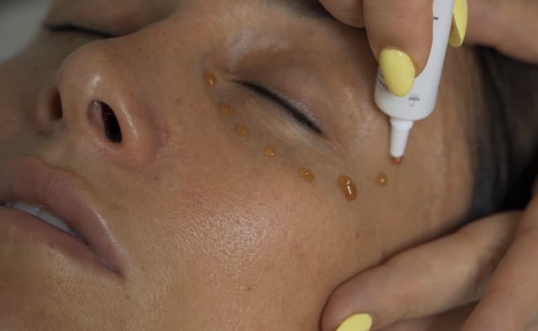 Mirada luminosa (peeling)